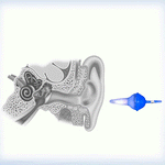 Load image into Gallery viewer, Innovative Inflatable Earplugs
